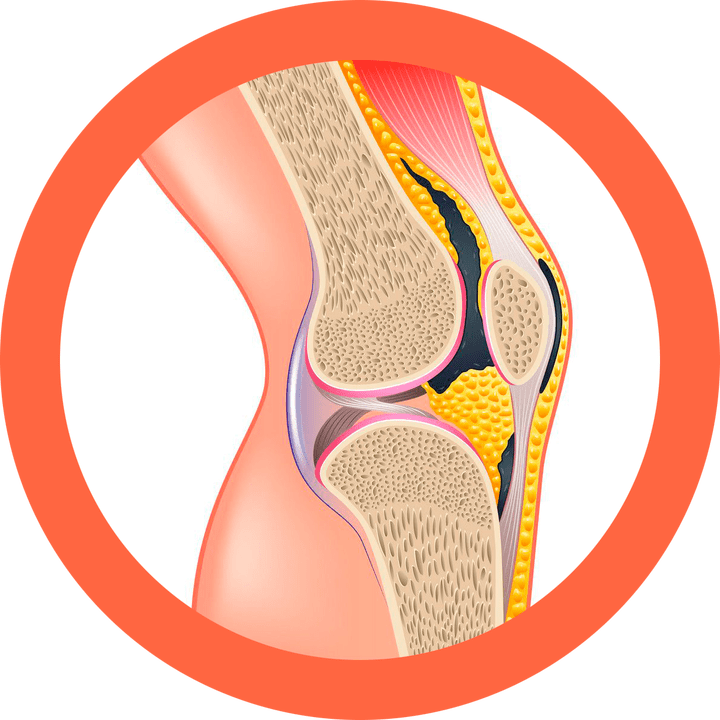 Hondroten - obnovuje kĺby a svaly
