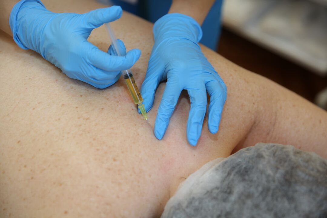 injekcie chondroprotektorov pre chrbát