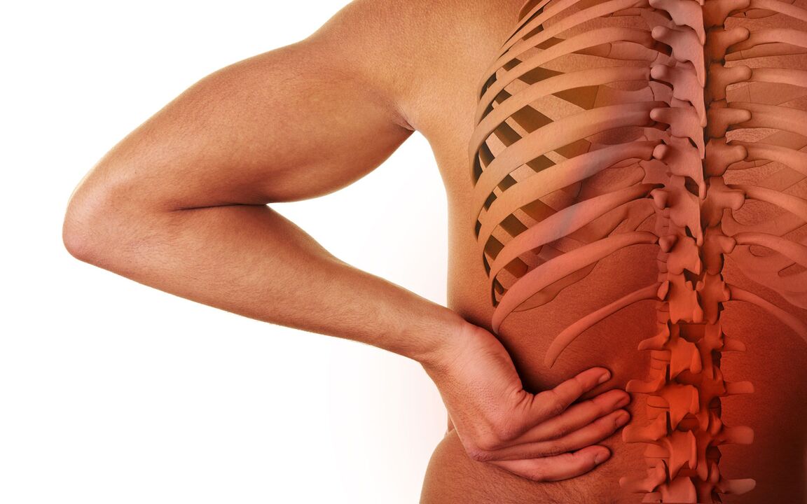 príznaky bedrovej osteochondrózy